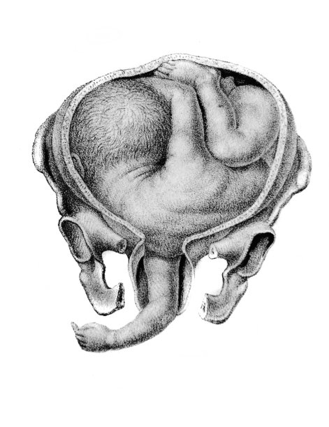 1841年，柏林，d·w·布希的《阿特拉斯·阿比顿根》旧书中婴儿的出生图片下载