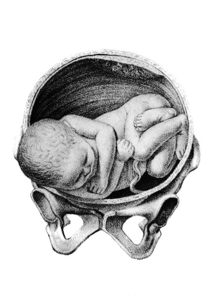 1841年，柏林，d·w·布希的旧书《阿特拉斯·阿比顿根》中，母亲子宫内侧的婴儿图片下载