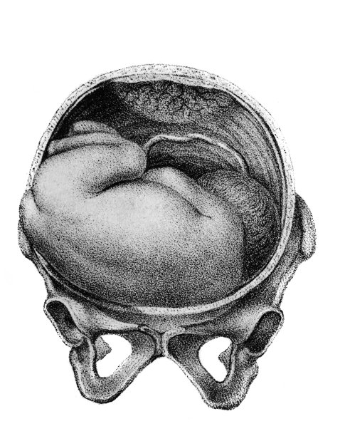 1841年，柏林，d·w·布希的旧书《阿特拉斯·阿比顿根》中，母亲子宫内侧的婴儿图片下载