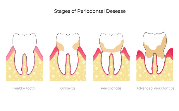 孤立的牙齿图片下载
