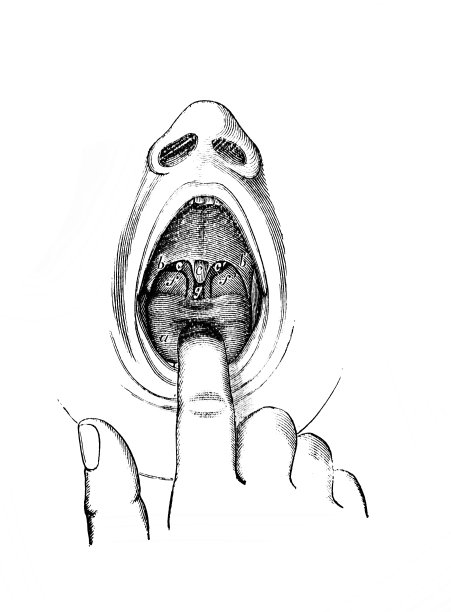 医生检查舌头和喉咙在旧书人类生理学查普曼，费城，1887图片下载