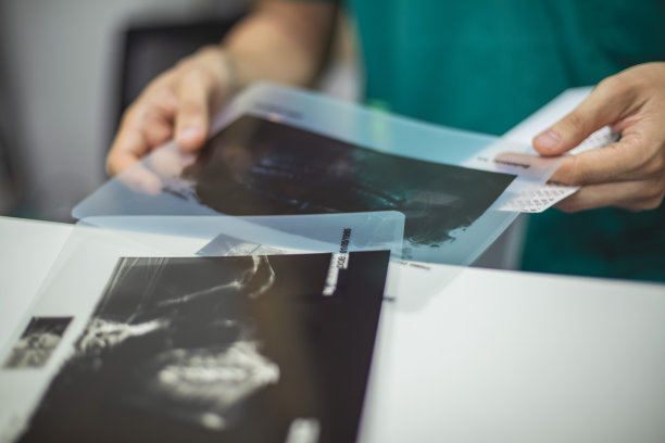 颌骨扫描的结果图片下载