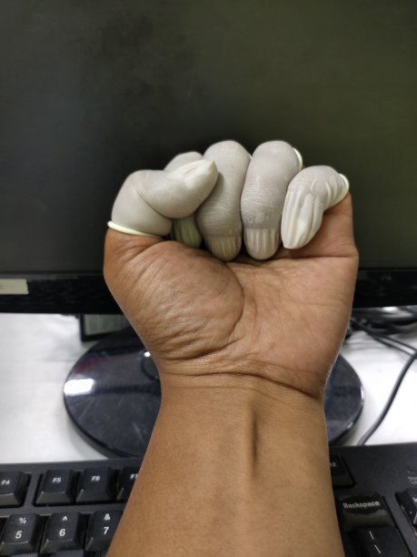 给有冠状病毒治疗方案的人拍照图片下载