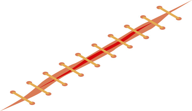 事故缝合图标等距样式图片下载