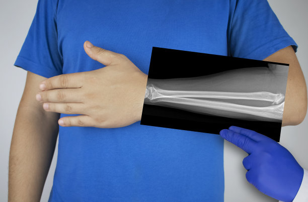 一个男人前臂的x光片。一幅辐骨和尺骨的照片被送到病人的手上。放射科医生检查x光检查。图片下载