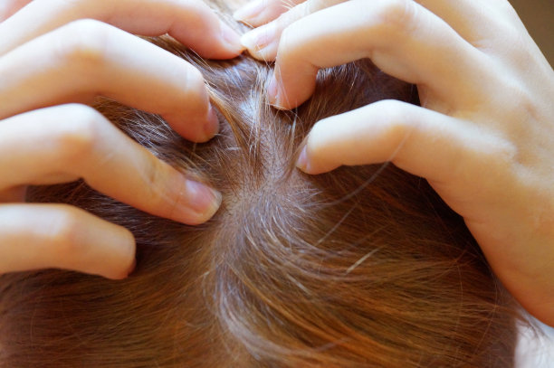 女性的手触摸头顶图片下载