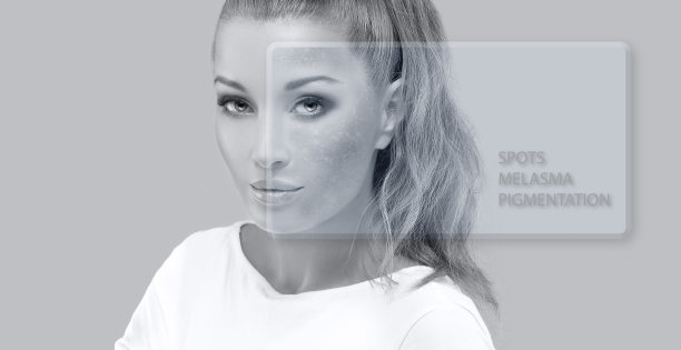 黑斑，雀斑，色素沉着(黄褐斑或黄褐斑)，概念-皮肤美白，皮肤美白，果酸，AHA，亮肤图片下载