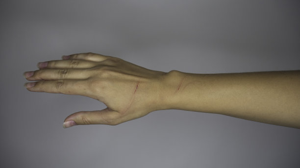 灰色背景上，一个女人的手被猫抓了。图片下载