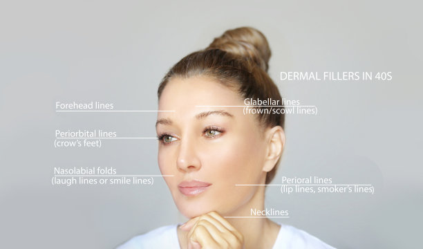 皮肤填充治疗。特定部位的透明质酸注射。正确的皱纹图片下载