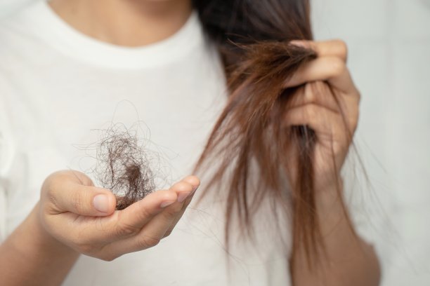 女性因洗发水过敏而脱发。图片下载