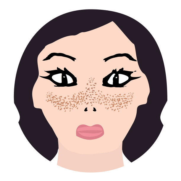 脸上的雀斑，皮肤上的色素沉着图片下载