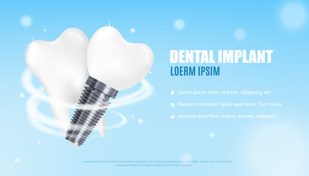 牙科网络横幅模型与现实的牙科种植矢量插图。图片下载