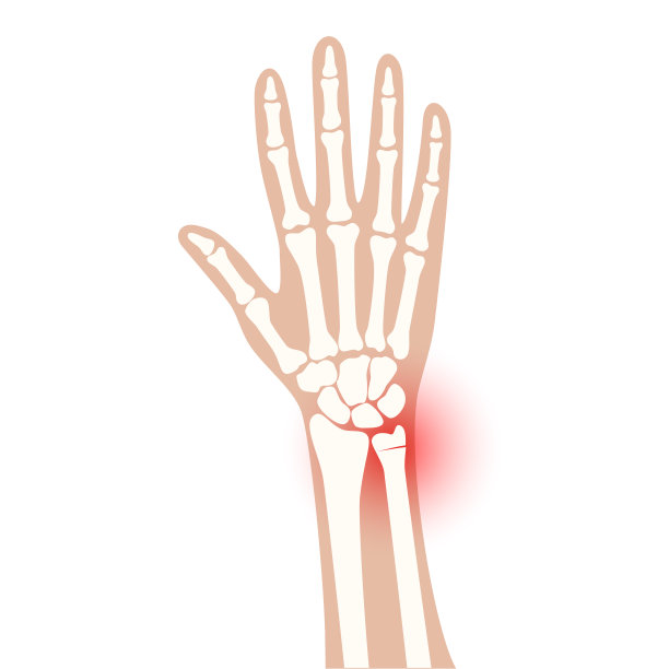 骨折x射线概念图片下载