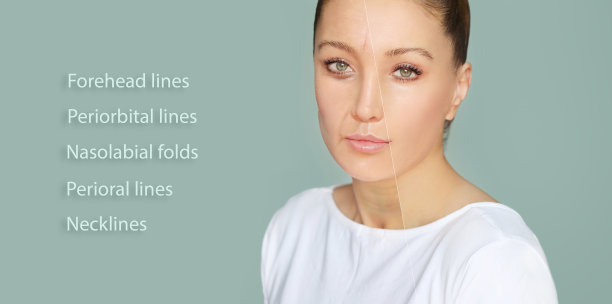 衰老的影响，皱眉/皱眉线，鼻唇沟，颈部，眼圈下，颈部线。整形手术的结果图片下载