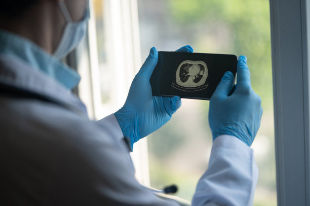 放射科医生戴着防护口罩和手术手套在智能手机屏幕上检查Covid-19患者的Cat扫描照片图片下载