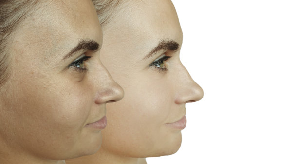 女人脸部皱纹治疗前后拼贴图片下载