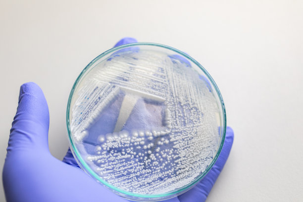 培养皿酵母菌，实验室微生物学教育。图片下载