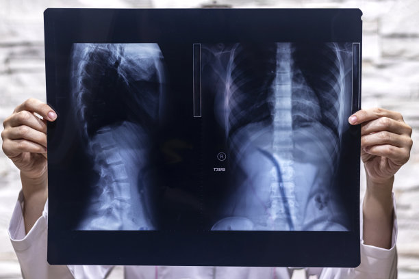 在医院里看病人x光的医生。医疗保健理念。图片下载