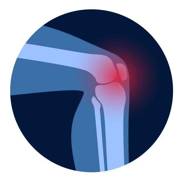 膝关节关节炎图片下载
