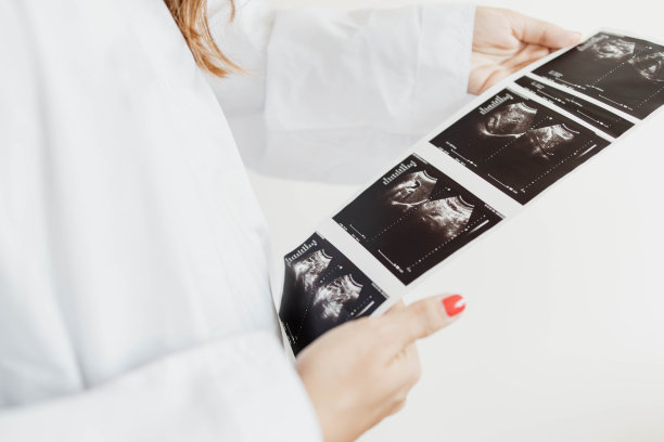 超声检查结果图片下载