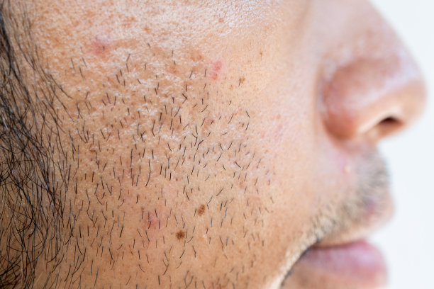 男人脸颊上的面部毛发的侧视图。图片下载