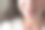 特写女人微笑的牙套。口腔正畸治疗。身体积极的。软焦点图片下载