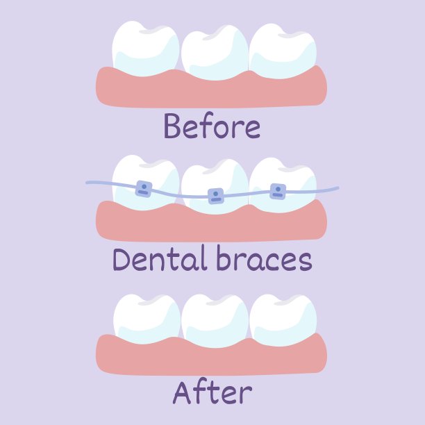 牙槽矫正前后牙齿排列的阶段图片下载