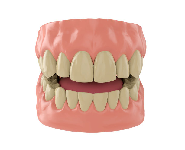 人类下巴与黄色的牙齿孤立在白色，3d渲染图片下载