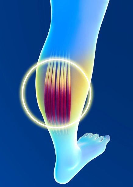 肌肉拉伤，肌肉发炎。小腿。抽筋。肌腱。挛缩图片下载