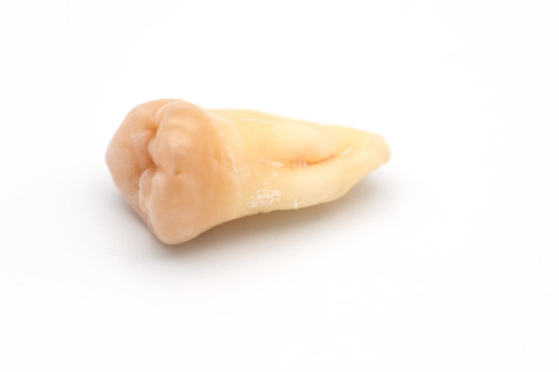 真正的智齿。在桌子上用来拔牙的牙科器械。血迹斑斑的破牙。智齿图片下载