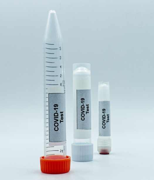 白色背景上分离出带有Covid-19标记的试管。冠状病毒,Covid-19测试图片下载
