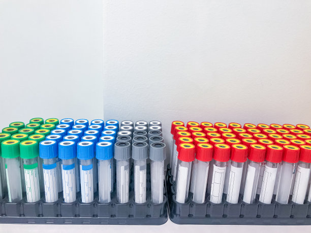实验室试管人血尿液样本分析测试照片图片下载