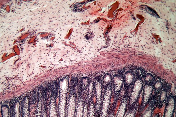 狗直肠细胞的显微镜照片。图片下载