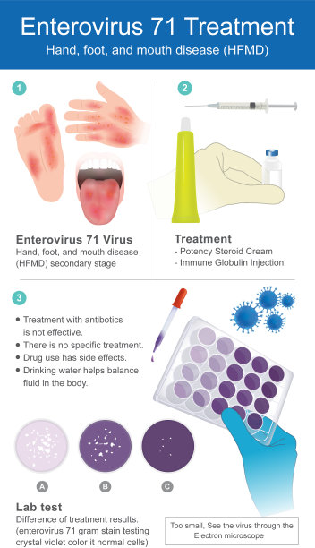 肠病毒71型治疗解释皮肤图片下载