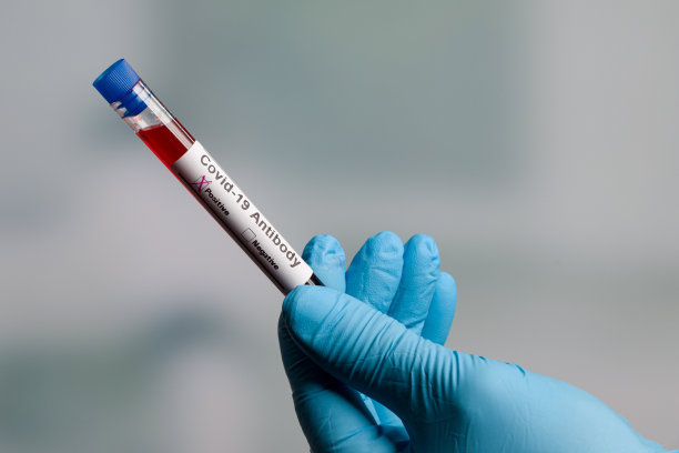 一只戴着医用手套的手拿着血液探针检查冠状病毒图片下载