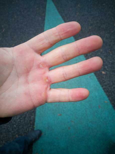 手上有玉米，手掌上有老茧图片下载