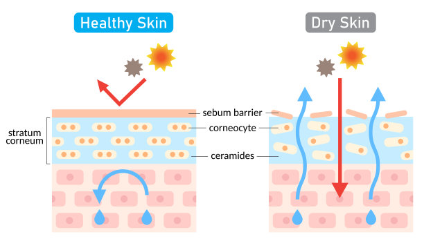干燥和健康的皮肤层插图。美容护肤理念图片下载