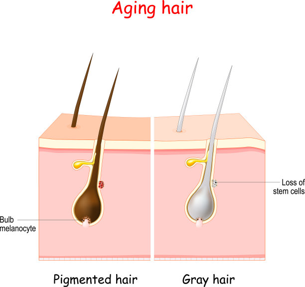 衰老过程中通过灰色头发着色和图片下载