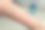 幼儿在母亲手臂上的咬痕——幼儿攻击行为心理学。图片下载