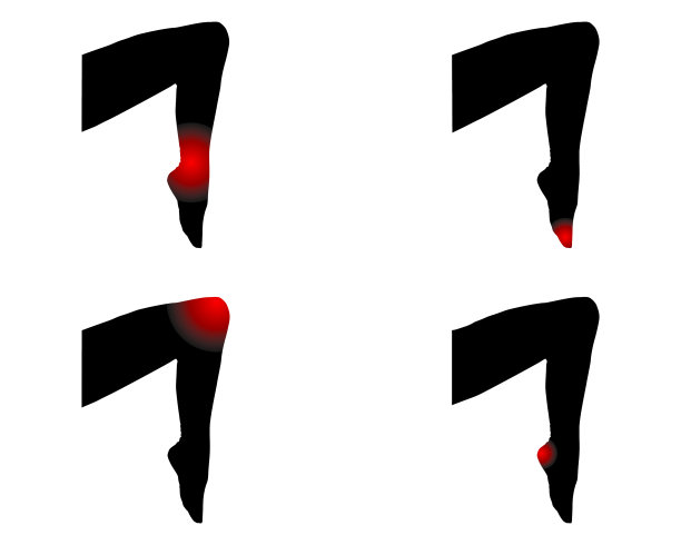 人的腿有痛点图片下载