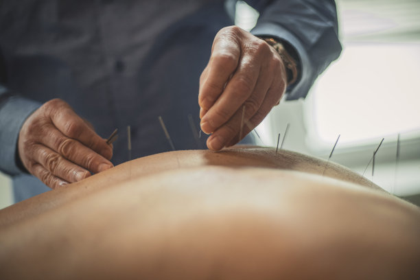 回针灸图片下载