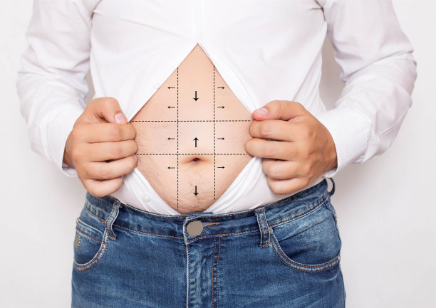 为了减少上班族穿衬衫的腹部脂肪而进行整容手术的标记。整形外科概念，脂肪团，抽脂图片下载