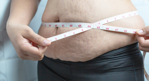 肥胖的女人需要控制体重，因为她有多余的脂肪。图片下载