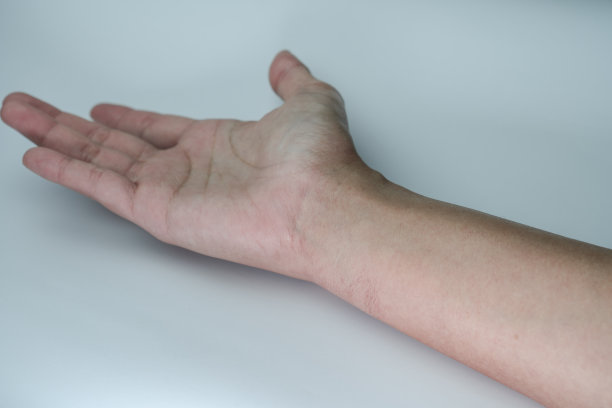 皮炎的皮肤图片下载