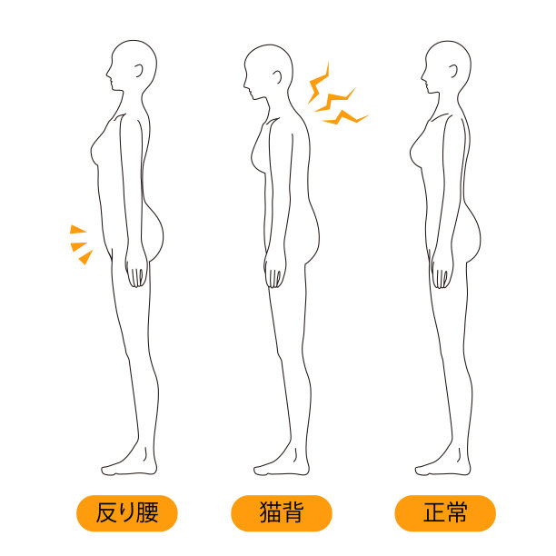 不良姿势插画（驼背/胸椎）图片下载