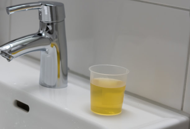 尿在一个塑料杯附近的白色水槽水龙头。图片下载