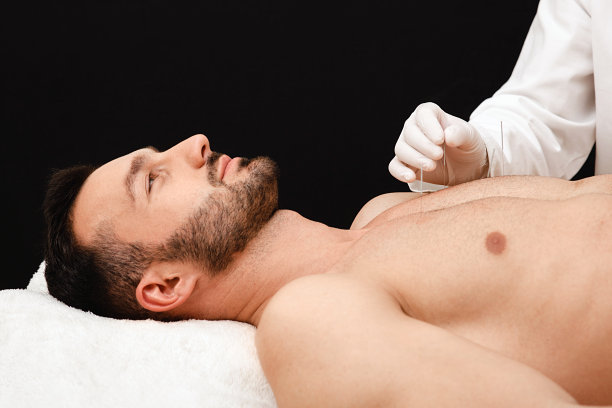 针灸师把针插在人体经络上的特殊穴位上。针灸针在反射学家的手接近黑色背景图片下载