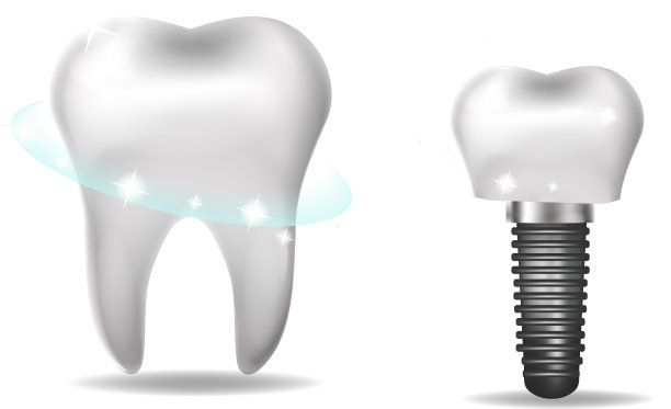 牙科种植修复3d逼真的风格图片下载