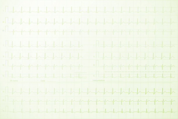 本文以心电线为背景图片下载