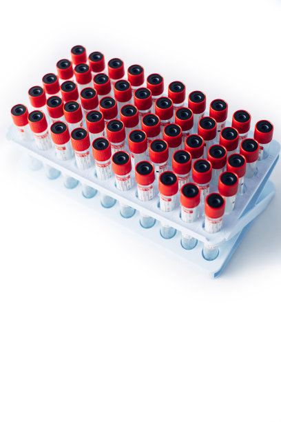 清空检测血管图片下载